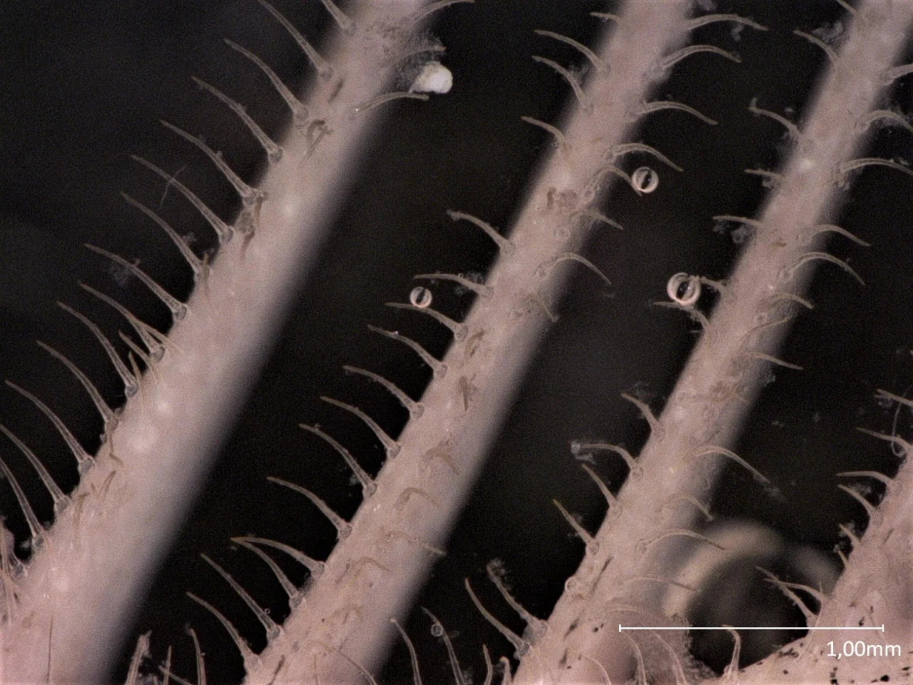 A close look at the gill arches (rakers) and their plankton-catching teeth (denticles)